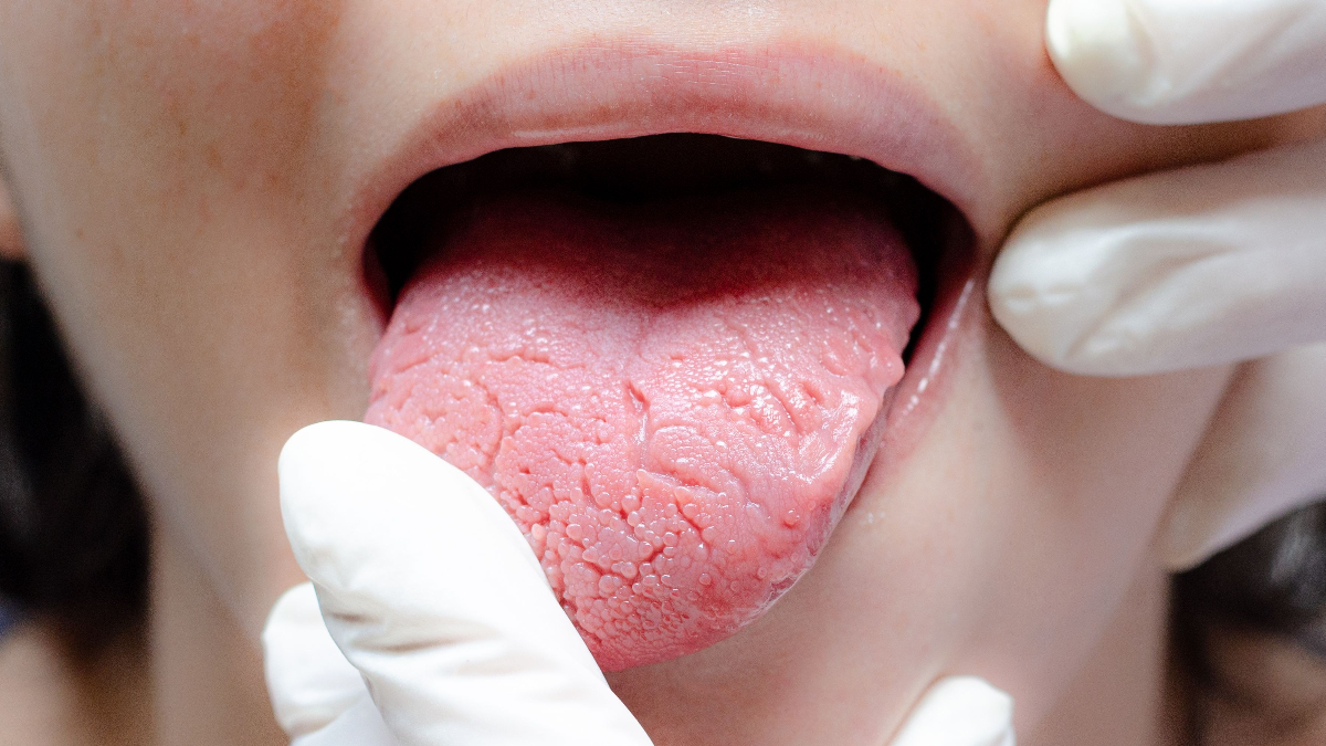 dil vucudun aynasi bu degisimlere dikkat YN39DpkP