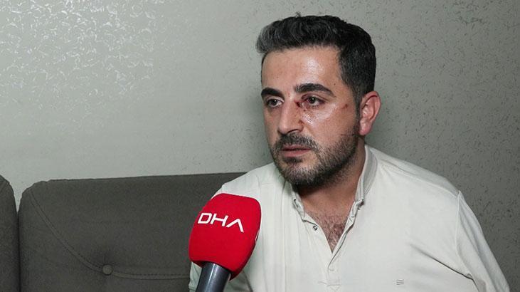 yer esenyurt eski kiraci ev sahibini bicakla yaraladi eWg2Hfha.jpg